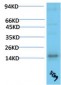 TTR mouse Monoclonal Antibody(5G9)